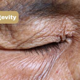 Voeding en longevity van de huid